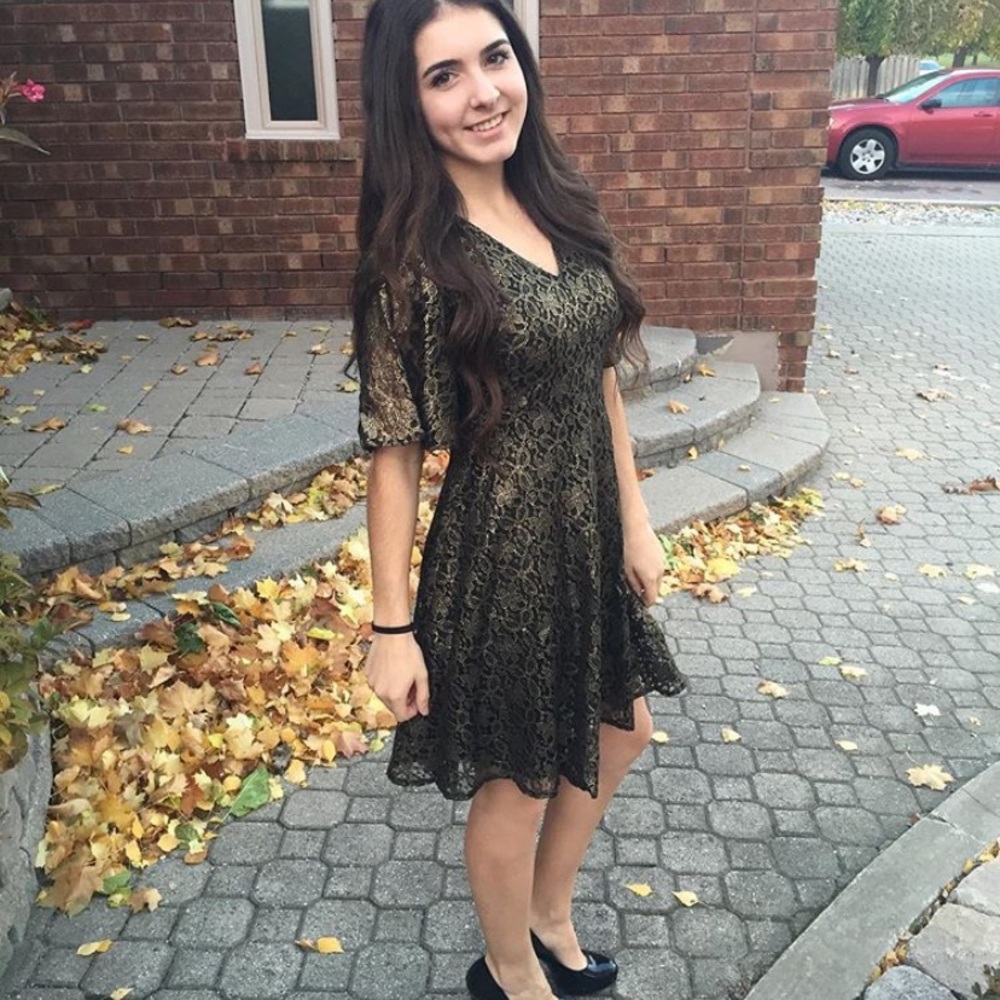 Black and Gold Lace Dress